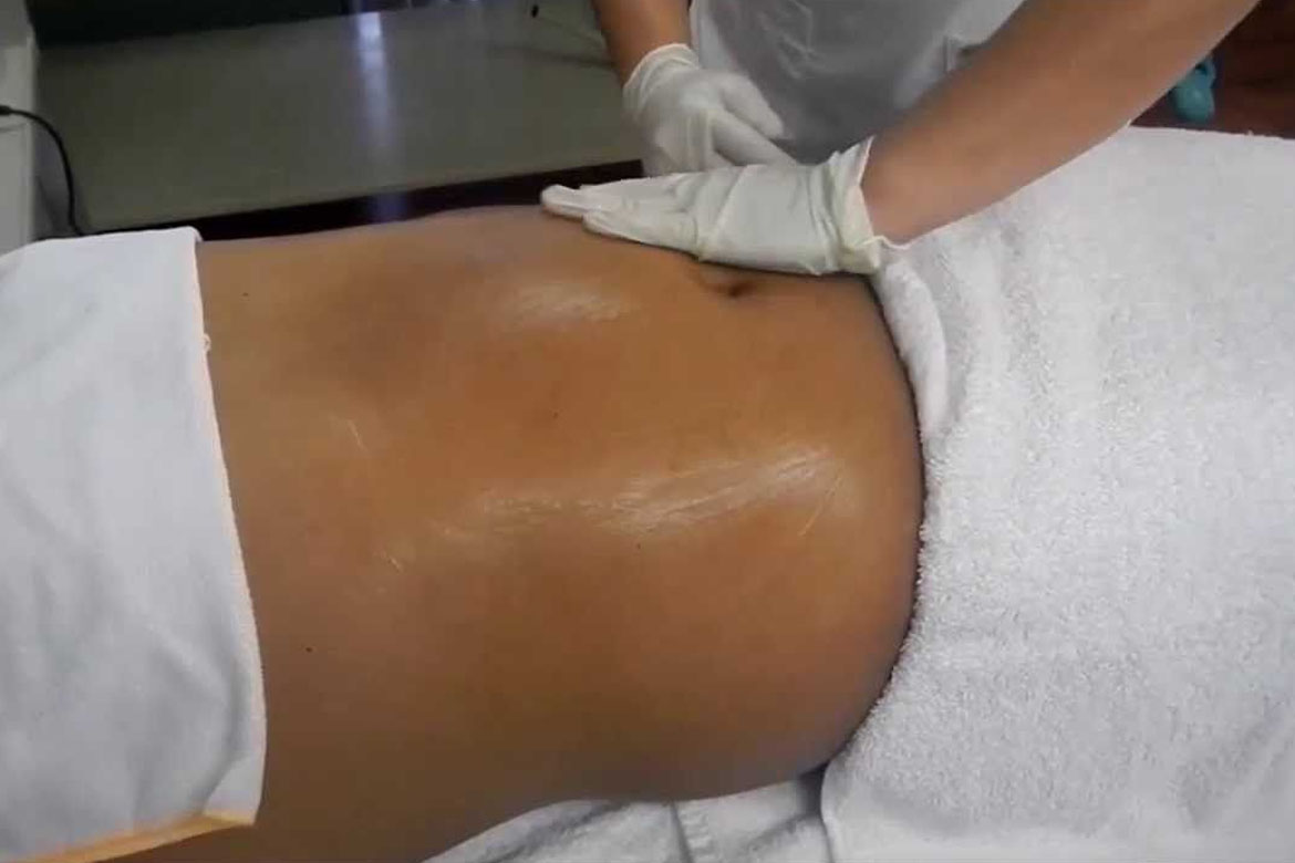 drenajes post operatorios en Kinesiologia ADN